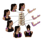 Referred Pain - Patterns